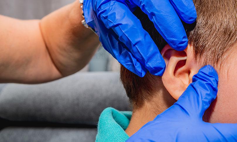 incisionless otoplasty